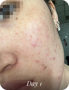 Before using 