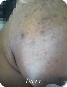 Before using 