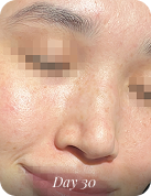 After using 