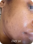 After using 