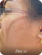 After using 